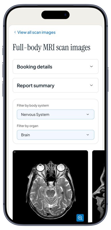 Core Vitals - Sample image results of your full body MRI scan