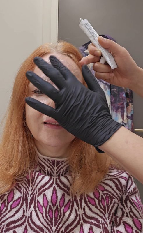 Applying numbing cream before skin boosters in London
