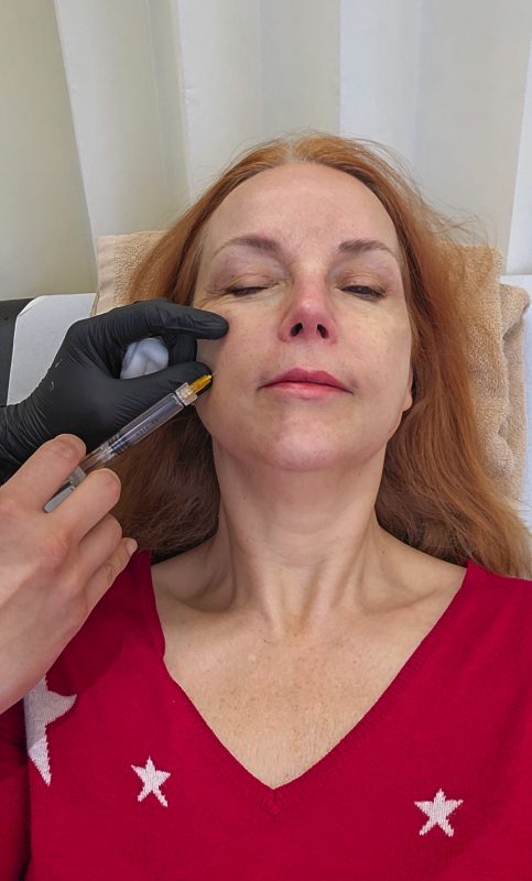 LuxuryColumnist - Skin boosters in London